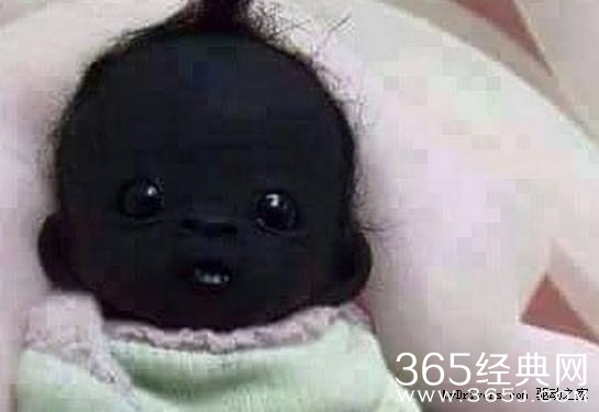 世界上最黑的孩子