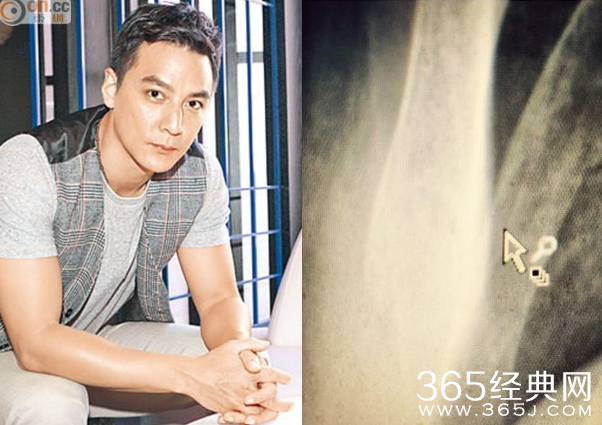 吴彦祖拍戏从高空摔下肋骨摔出裂缝