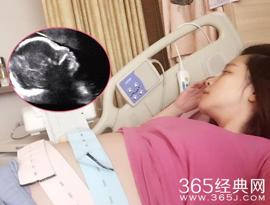 徐若瑄怀孕27周晒宝宝超音波照赞儿子侧面帅