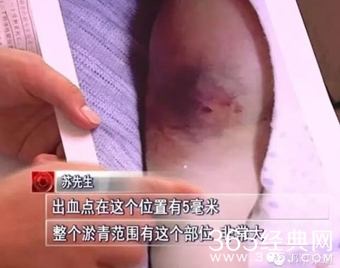 男婴接种疫苗后离奇死亡 40天男婴为何接种疫苗死亡？