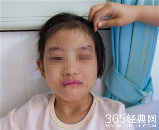湖北6岁女孩被后妈虐待骨折 桃桃后妈蔡某资料遭人肉