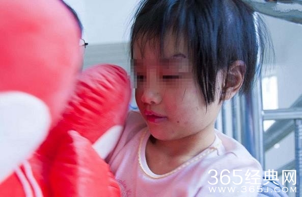 湖北6岁女孩遭后妈虐待 多出软组织受损