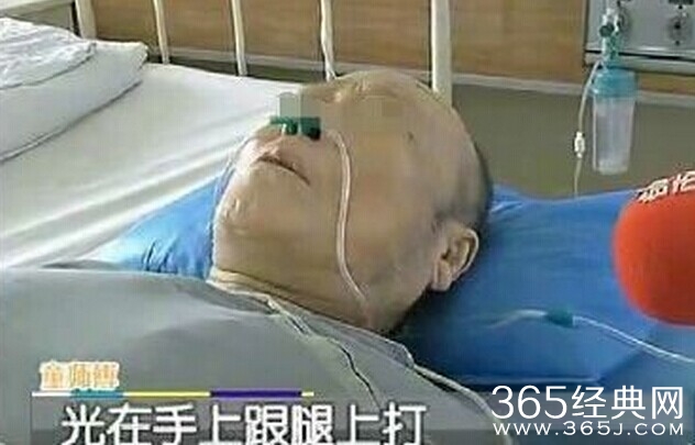 老人闹市遭暴打手脚被轮番殴打致残令人发指