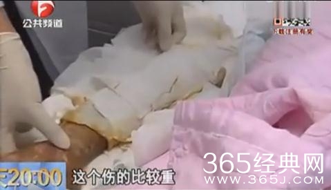 李娟被狗咬视频 狗嘴下救女童是谎言