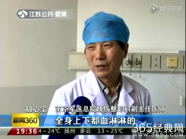 李娟救女孩被狗咬成重伤事件真相 并非救人被咬