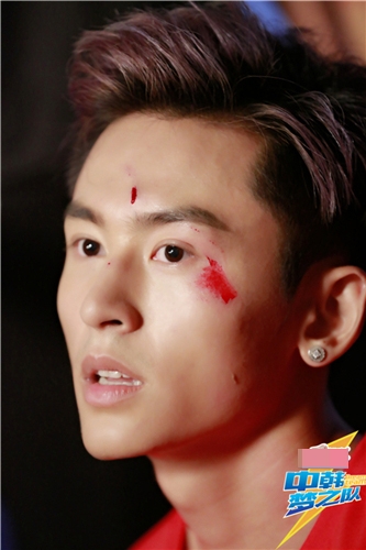 中韩梦之队张哲瀚受伤毁容吗？张哲瀚为什么会受伤毁容？