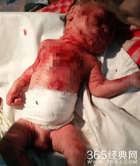 15岁母亲产子后用竹签扎死男婴现场照片