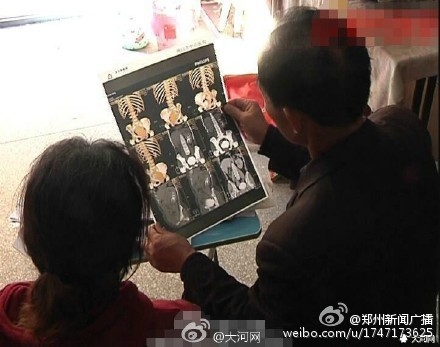 做手术右肾神秘丢失 警方不予立案调查