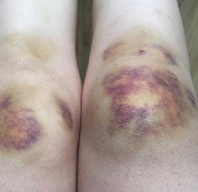 新闻哥：你们家乡开始下雪了吗？2015.11.06