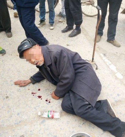 宿州80岁老人街头吐血乞讨