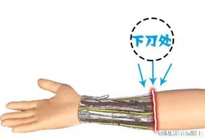 新闻哥：你们的家乡开始下雪了吗？2015.11.25