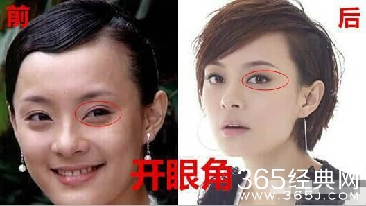 孙俪自曝整过容