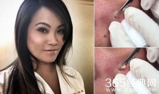 桑德拉•李(Sandra Lee)挤豆视频疯传网络