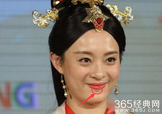 孙俪嘴唇下的痣是怎么回事?
