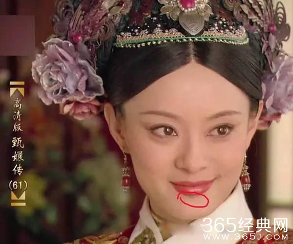 孙俪嘴唇下的痣是怎么回事?