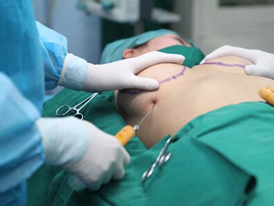 假胸破裂大腿溃烂女子李慧照片 隆胸假体破裂致大腿烂穿