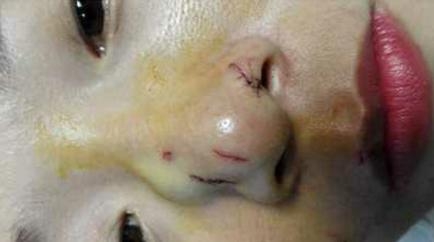 新闻哥：与动物亲密需谨慎！2016.01.11