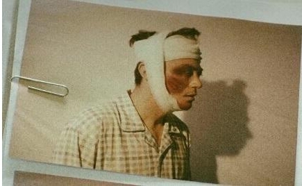 霍建华脸被打肿怎么回事 真相禁区霍建华脸被打肿照片