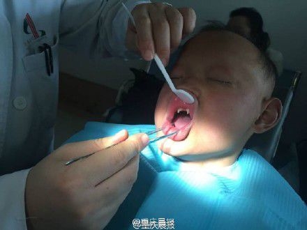 少年患病似吸血鬼怎么回事 家族都这样或与近亲结婚有关