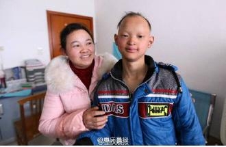 少年患病似吸血鬼怎么回事 家族都这样或与近亲结婚有关