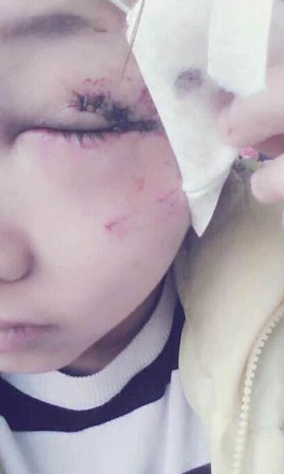 嘉峪关散打哥拘留所照片曝光 被打女生照片近况