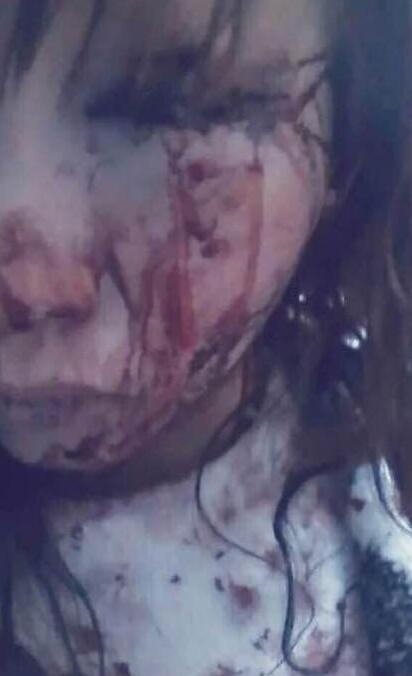 嘉峪关散打哥拘留所照片曝光 被打女生照片近况