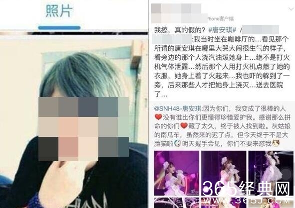 23岁唐安琪烧伤案续：疑遭女伴泼汽油 纵火者系粉丝