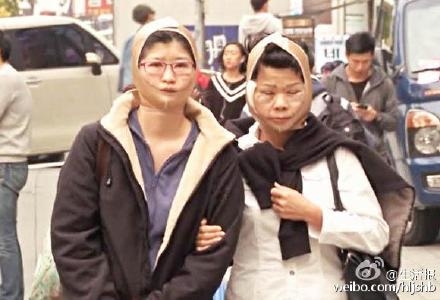 女子因脸大被离婚 瘦脸三次后毁容