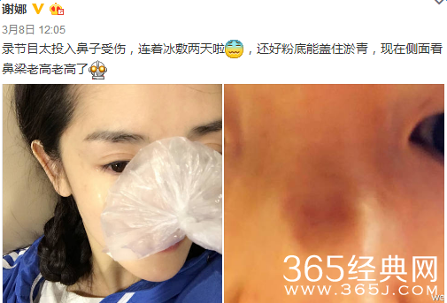 快乐大本营谢娜太拼游戏中受伤