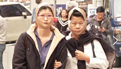 因脸大被离婚沈阳王大姐照片曝光 整容后变残太惊悚