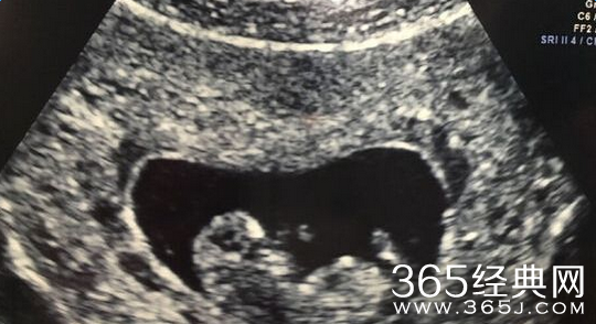 陶昕然老公系富二代 结婚纪念日宣布怀孕