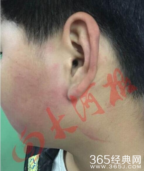 张红伟个人资料背景后台 校长殴打9岁小学生引民愤