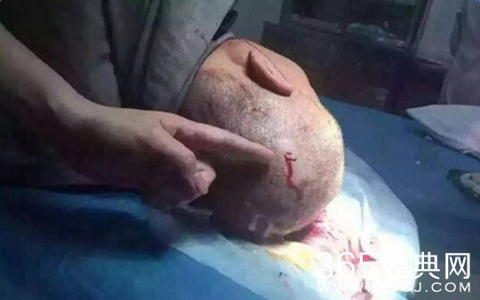 女警敲破保安头 涉嫌打人女警信息遭扒