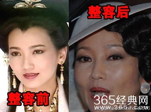 赵雅芝整容了吗 赵雅芝整容前后照片