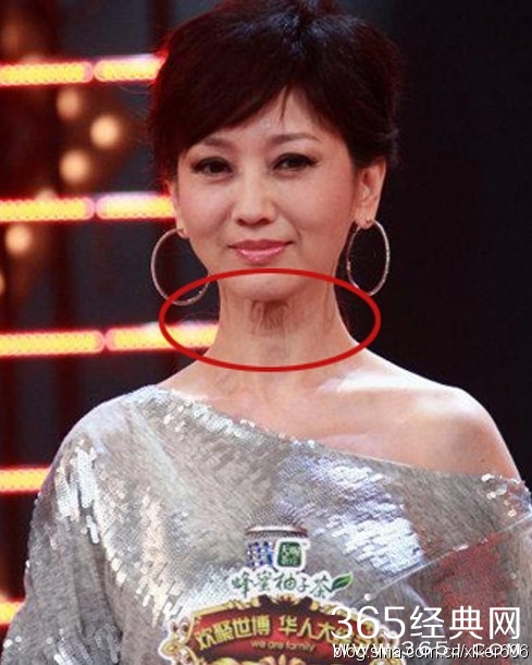 赵雅芝整容了吗 赵雅芝整容前后照片