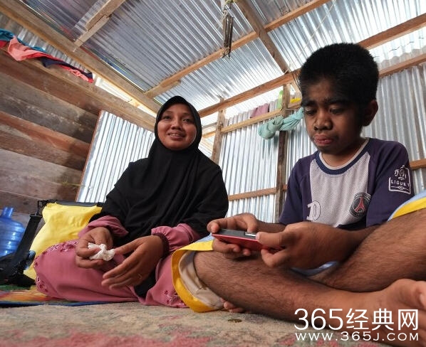 印尼13岁男孩返祖全身覆盖黑色毛发 称自己被神选中