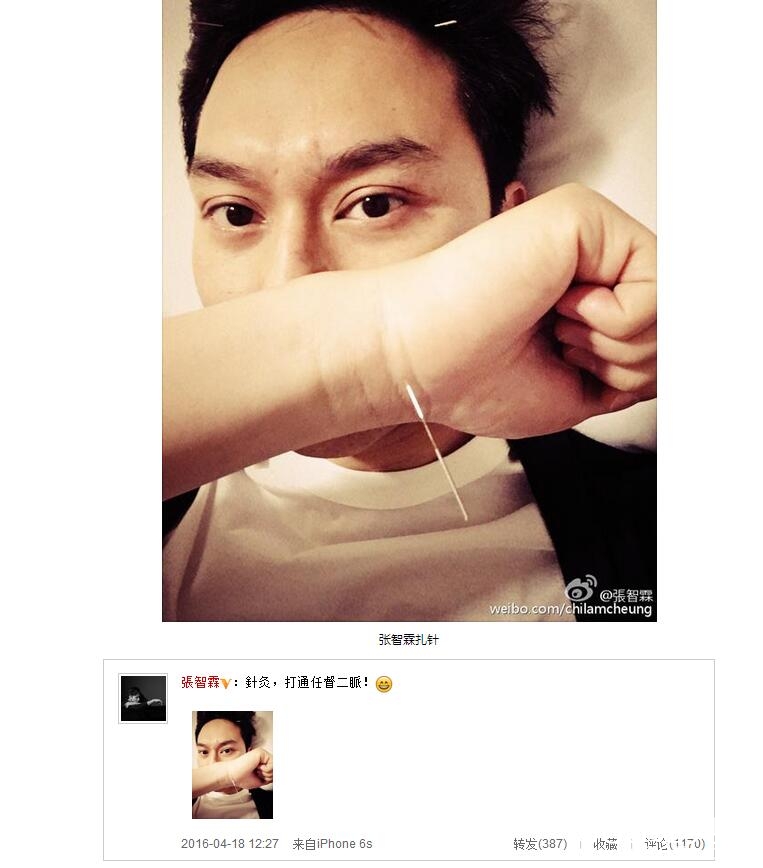张智霖自拍头手全扎针 笑称打通任督二脉
