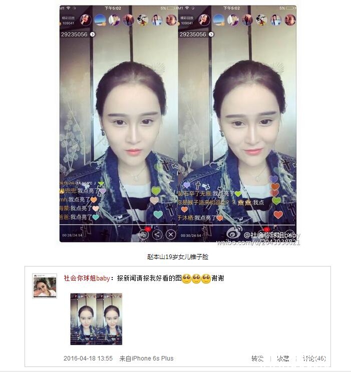 赵本山女儿锥子脸被疑整容 求媒体放美图