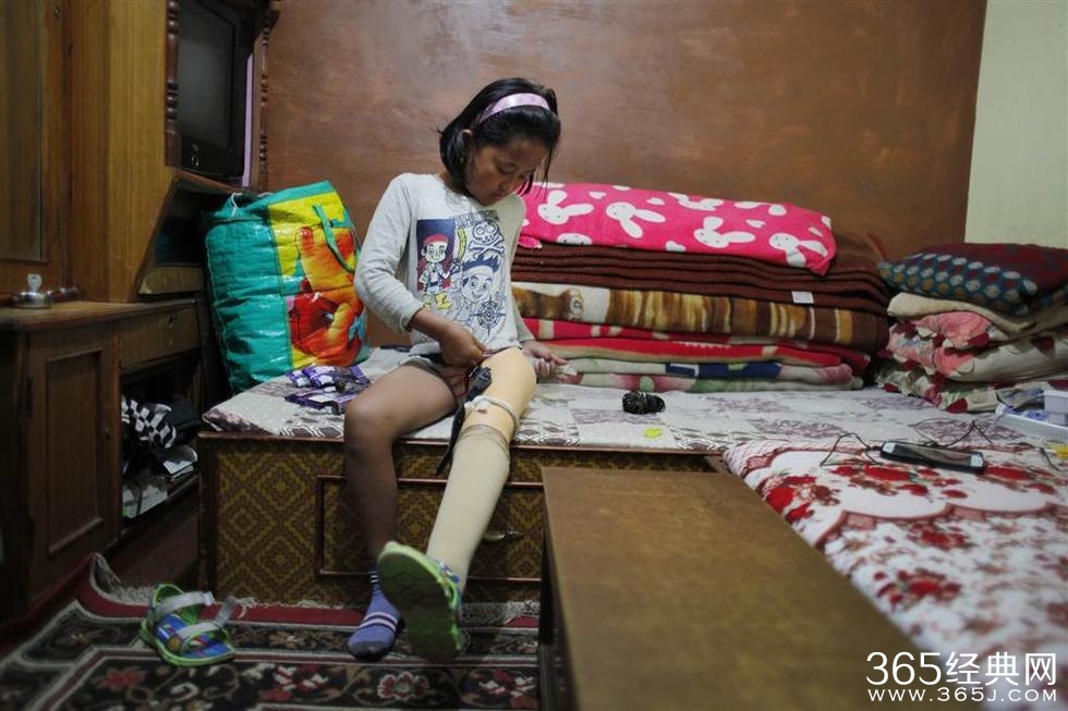 两女孩因地震各失去一条腿成挚友 共用一双鞋