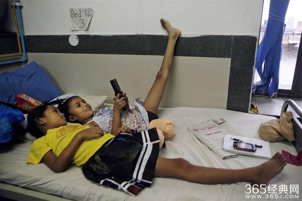 两女孩因地震各失去一条腿成挚友 共用一双鞋