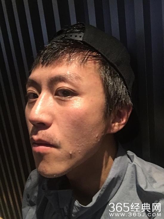 邓超15天暴瘦10斤 自拍瘦出锥子脸