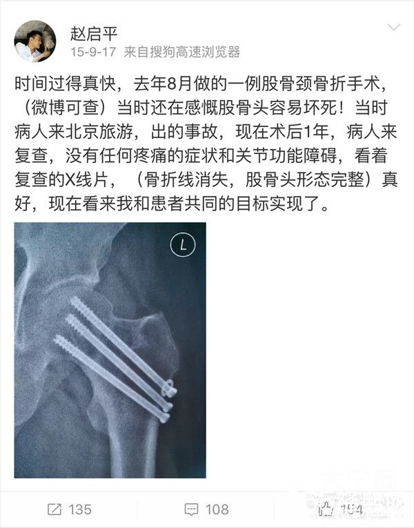 欢乐颂剧组有毒怎么回事？ 安迪被黑小三是真的吗？