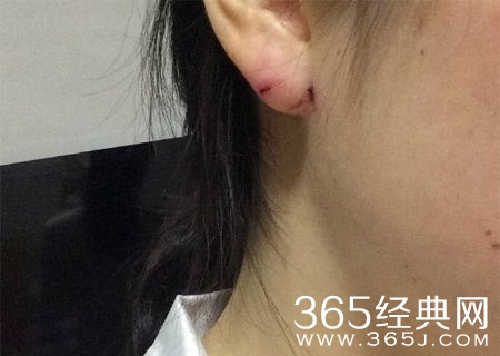 女子停车场遭假警察电击殴打:当时是白天没戒心