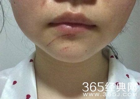 女子停车场遭假警察电击殴打:当时是白天没戒心