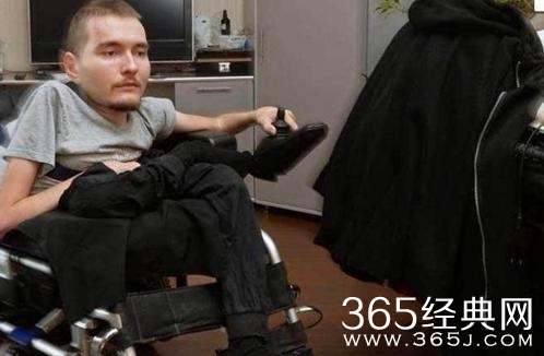 世界首例换头手术将实施