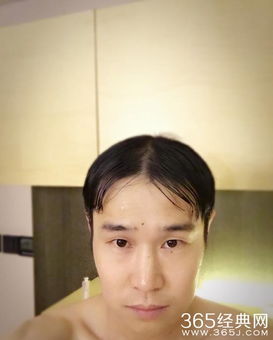 小沈阳晒半裸照发型抢镜！35岁已开始发量稀疏