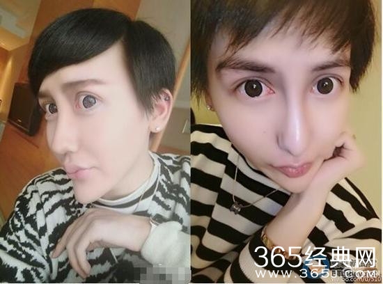 蛇精男小时候长这样！帅气小伙变车祸现场