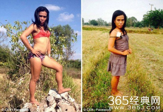 泰国网红人妖患癌症 粉丝捐助其割生殖器