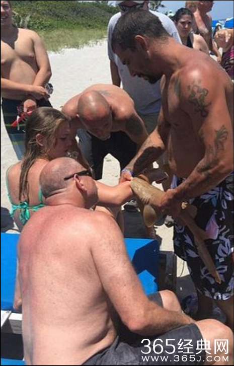 少女遭到鲨鱼攻击 牙齿嵌入手臂死不松口