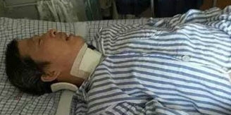 53岁大伯仰头喝可乐四肢瘫痪